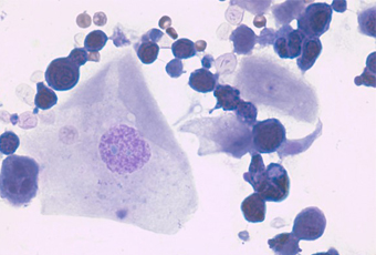 Urine sediment 검사 이미지