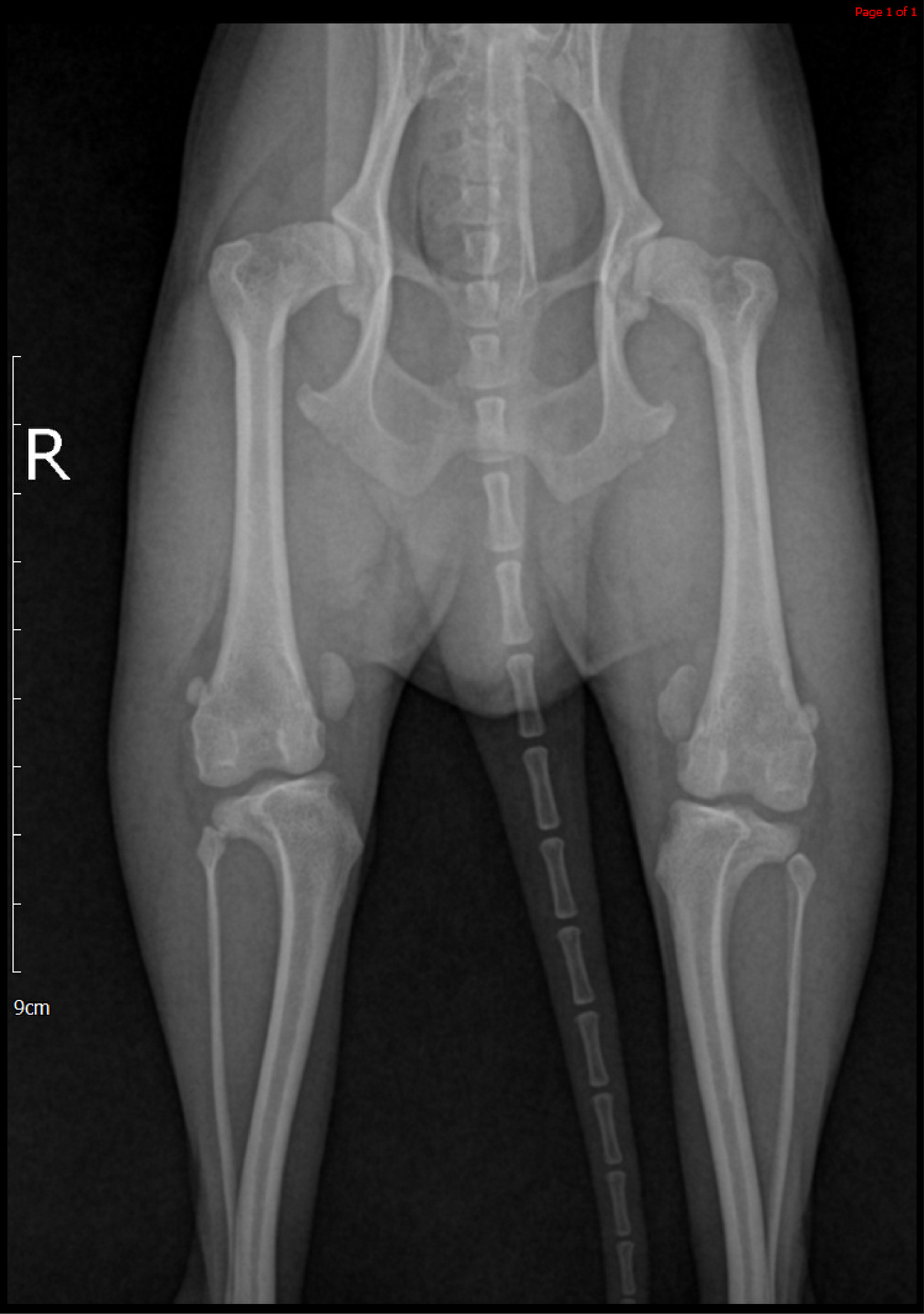 MPL correction (Before)