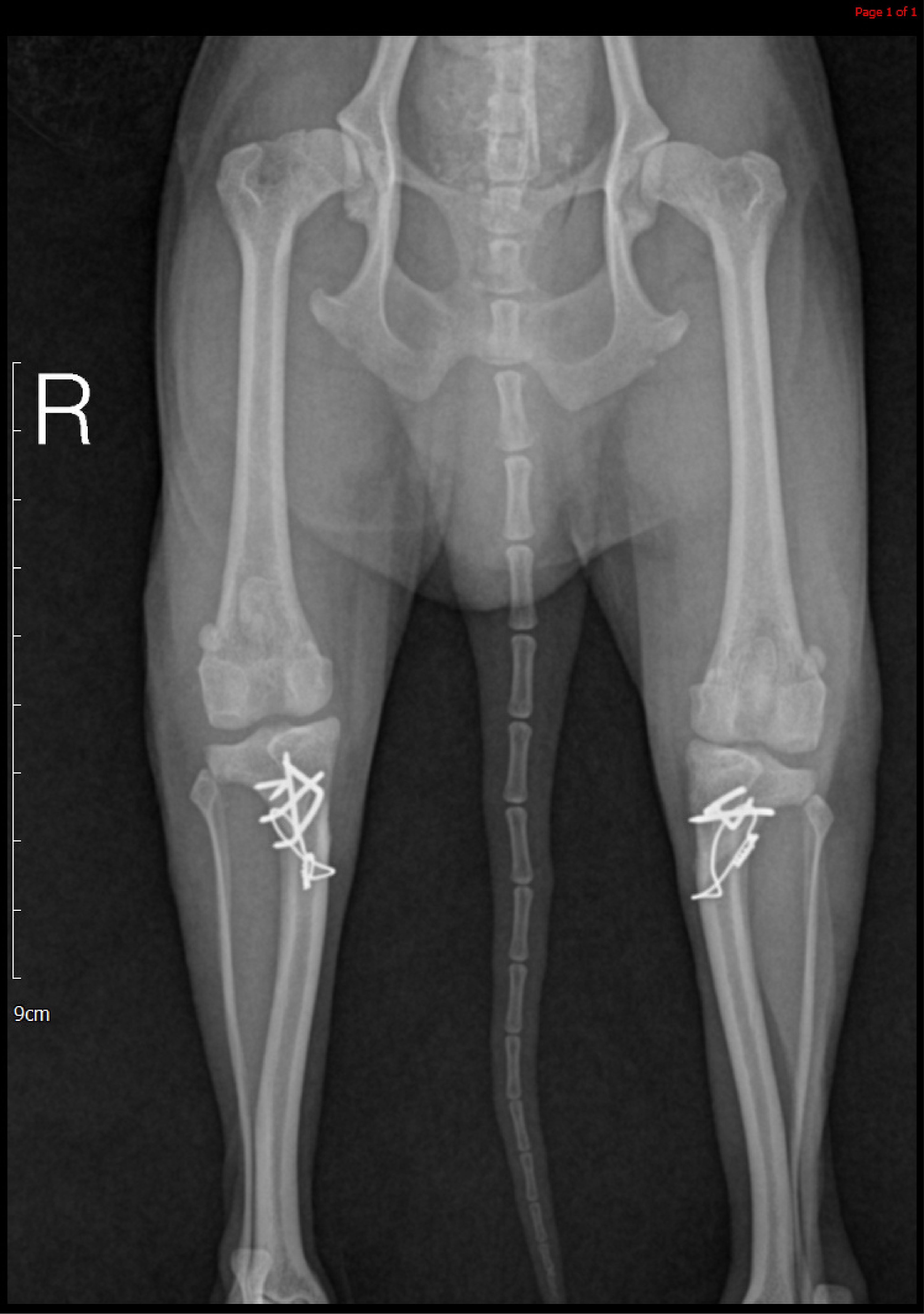 MPL correction (After)