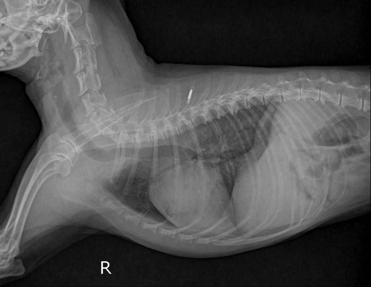 좌심이 비대된 환자의 X-ray 사진전